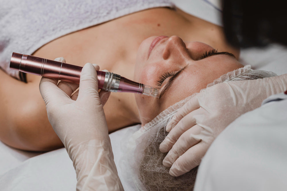 Microneedling, An Overview of the Procedure at All Saint Clinic