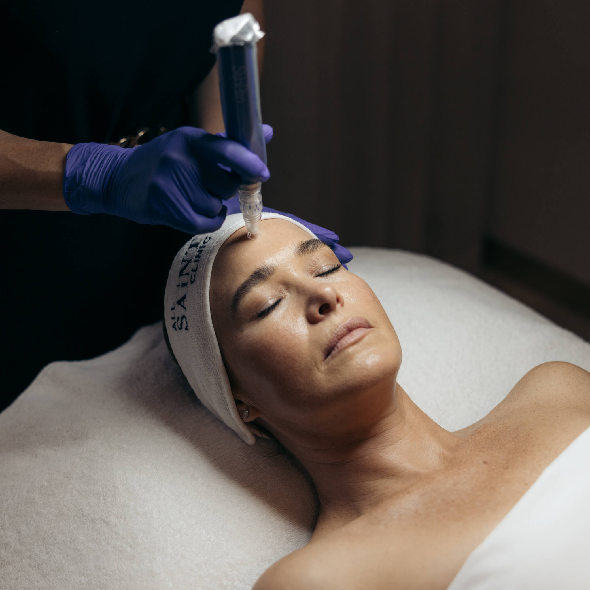 Skinpen Needling Sydney at All Saint Clinic