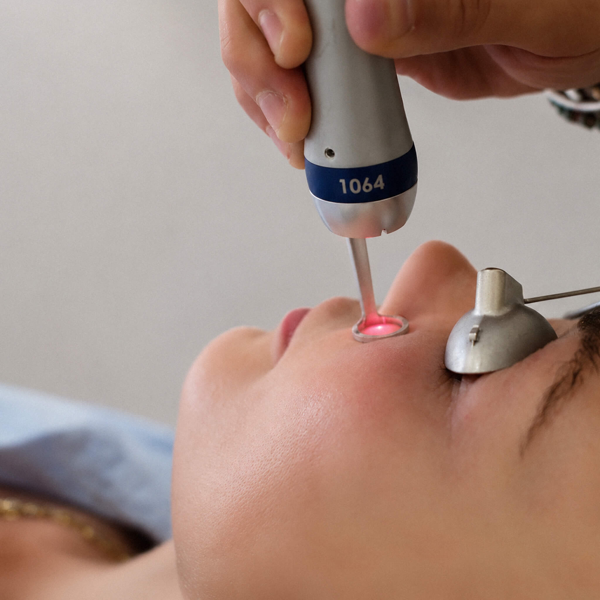 Pigmentation: Understanding Causes, Prevention and Treatment Options