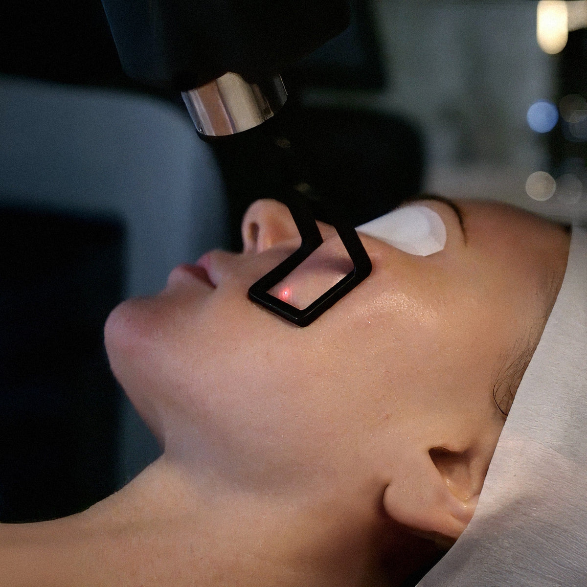 Is CoolPeel Safe for Darker Skin Tones and Pigmentation?